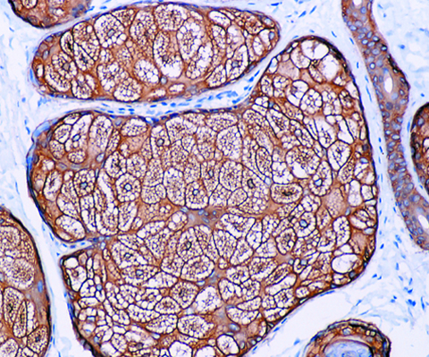 Cytokeratin 14 1,0 mL