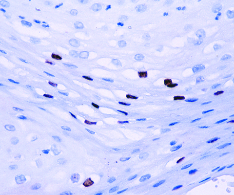 HPV-16 (CAMVIR-1) 1,0 mL