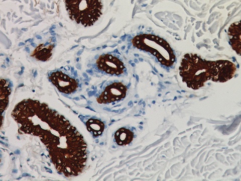 Cytokeratin 19 0,1 mL