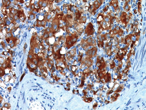 Synaptophysin 0,1 mL