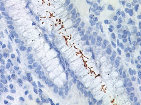 Helicobacter Pylori 0,1 ml