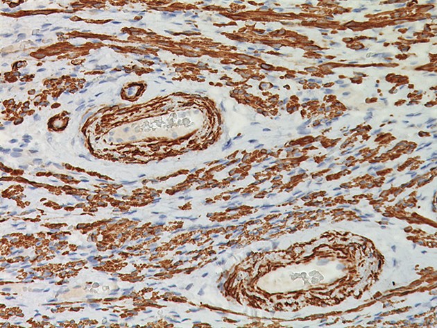 Smooth Muscle Myosin Heavy C. 0,5 ml