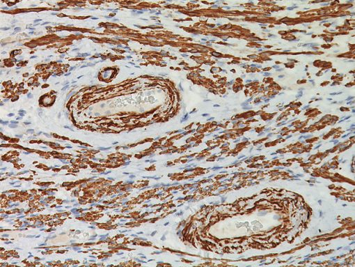 Smooth Muscle Myosin Heavy C 0,1 ml