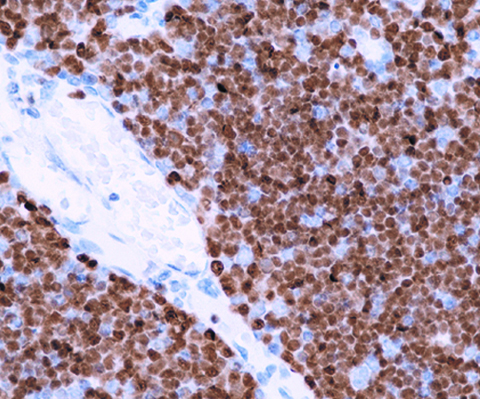 Terminal Deoxynucleotidyl Transferase (TdT) 1,0 mL
