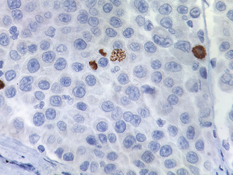 Phospho-Histone H3 0,1 mL