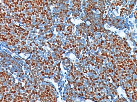 Cyclin D1 (SP4) 0,5mL