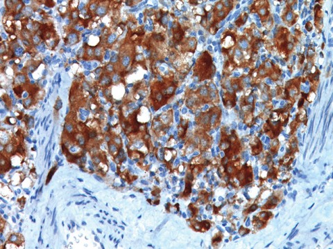 DAB Chromogen Kit 100 mL