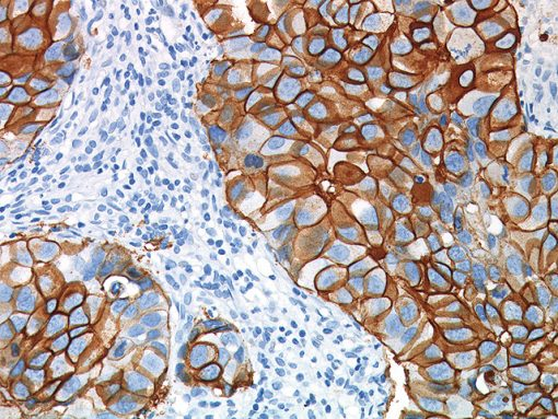 Betazoid DAB Buffer 25 ml