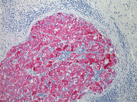 Vulcan Fast Red Chromogen Kit 2 25 ml