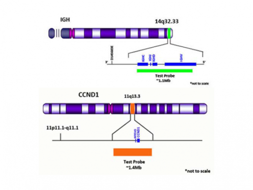 IGH (14q32) Green/ CCND1 (11q13) Orange 0.1 mL