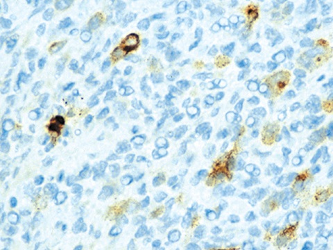 Epstein- Barr Virus (EBV) (Cocktail) 6.0 mL