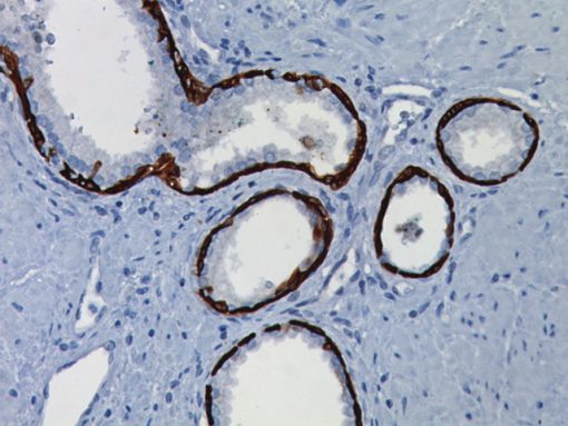 Cytokeratin 5, 6ml, RTU