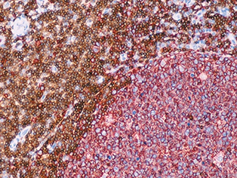 L26 + CD3 Double Stain 6mL