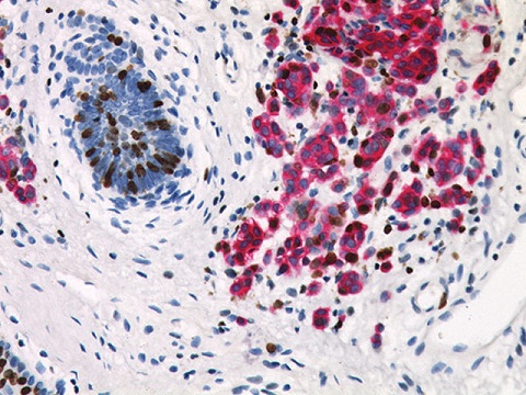 Pan Melanoma + Ki-67 25 ml