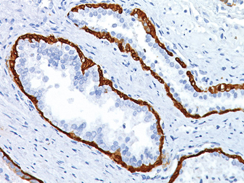 Prostate Cocktail, 2X (CK5+CK14+p63), 6ml