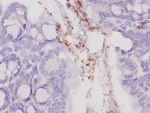 Helicobacter Pylori 100ml