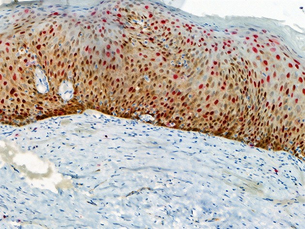 P16 + Ki67 Predilute Multiplex Antibody Reagent RTU 6,0 ml