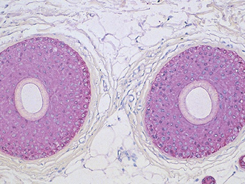 Pan Cytokeratin [AE1/AE3] 25mL