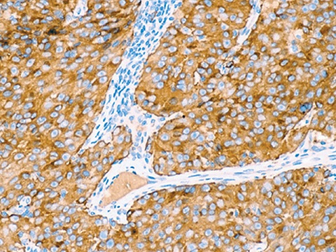 Pan Melanoma Coctail-3 (HMB45, Tyrosinase and MART-1) 5mL