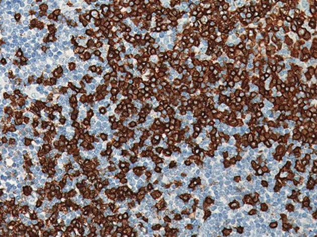 CD20 [L26] Predilute, IP FLX 10 ml