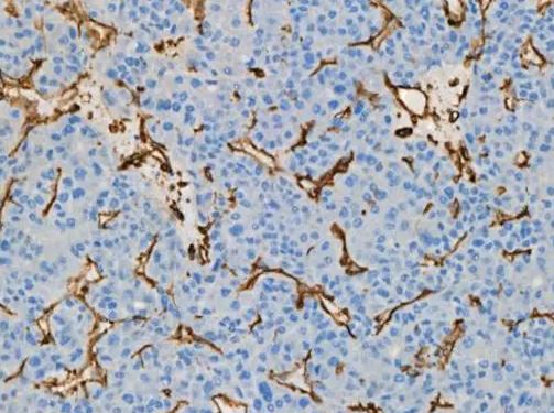 CD39 (EPR20627) 0,1 mL