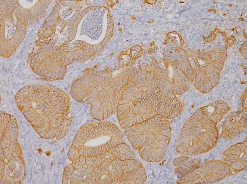 Claudin-4, Predilute, 6 ml