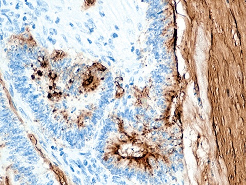 Tumor Associated Glycoprotein (TAG-72)  0,5mL