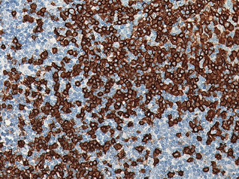 CD20 (B-cell) L26  0,1mL