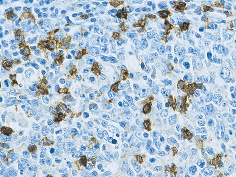 CD57 (Natural Killer Cell) 0,5mL