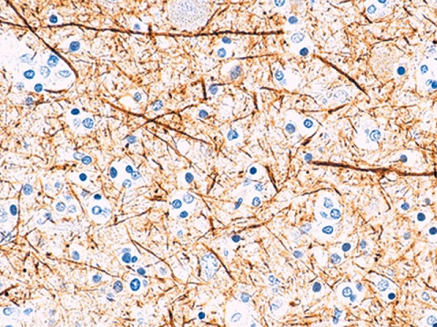 Neurofilament 0,5 mL