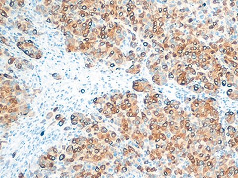 Melanoma Cocktail 0,5 ml