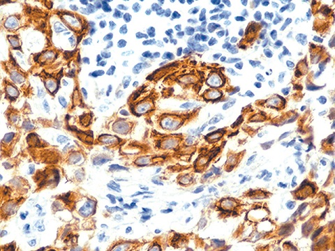 Cytokeratin 5/6 0,5ml