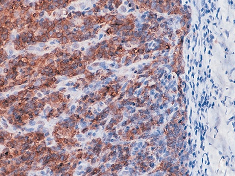 Epithelial Membrane Antigen (EMA) 0,5 mL