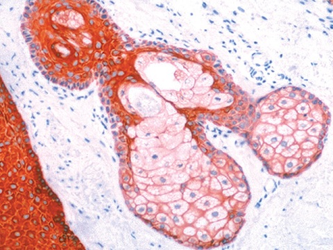 Pan Cytokeratin Plus [AE1/AE3+ 8/18] 0,5ml