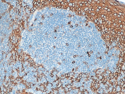 CD138 (Syndecan-1) 0,5mL