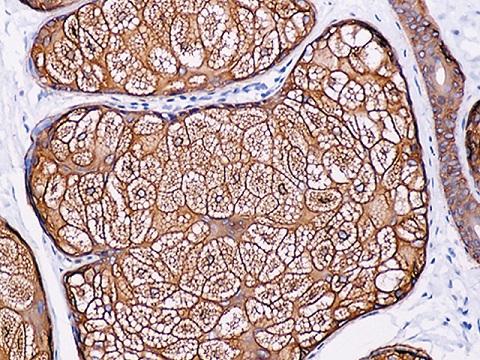Cytokeratin 14 0,5 mL