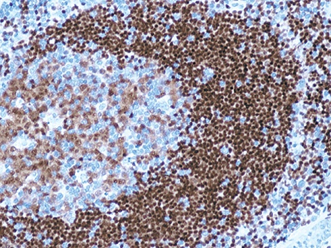 PAX-5 (Pan B Cell) 0,5 mL