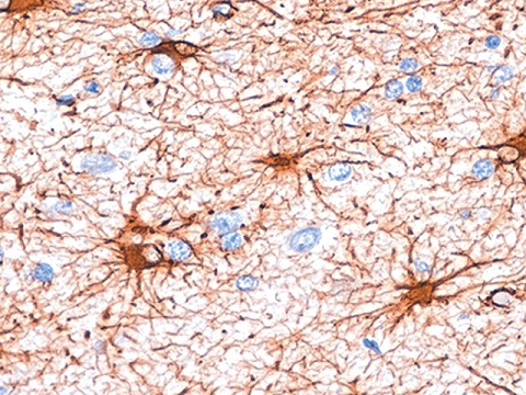 Glial Fibrillary Acidic Protein (GFAP) 0,1 ml