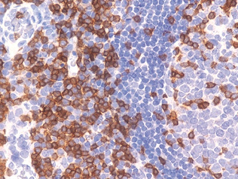 CD3 (T-Cell) Poly 0,1 mL