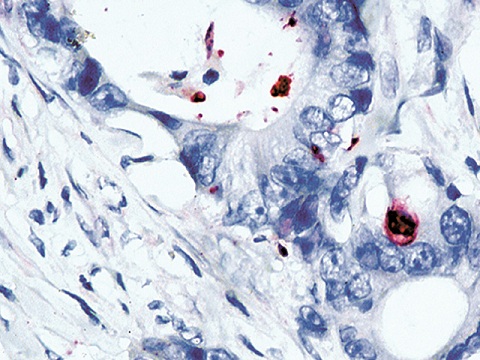 Caspase- 3 (cleaved) (p) 0,1 mL