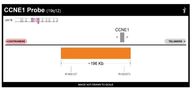 CCNE1 FISH Probe 20 test (40µl) RUO