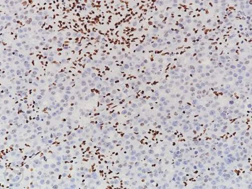 H3K27me3 [C36B11] 0.1ML