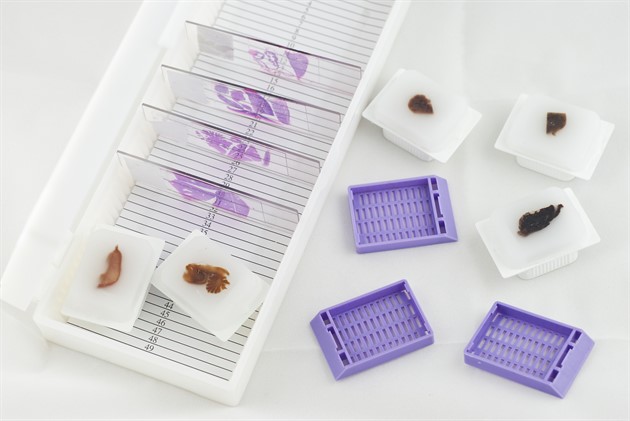 Kassetter &amp; Tillbehör