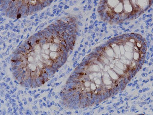 IFNG [IFNG/3996R] 0,1 ml