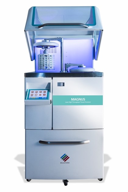 MAGNUS Complete Package Plus Configuration