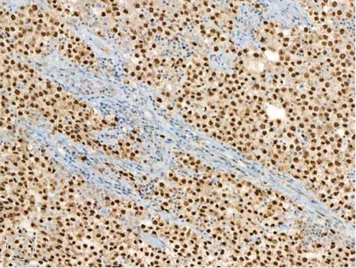 OCT 3/4 [N1NK] 0,1 ml