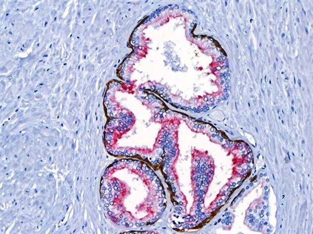 ONCORE Pro Hematoxylin