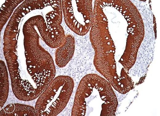 Pan Cytokeratin [AE1/AE3] 6 ml