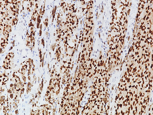 PRAME [EPR20330] 0,1 ml