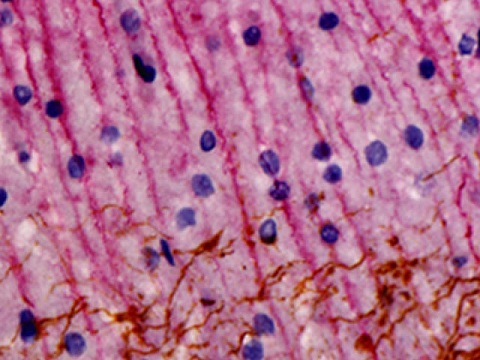 Rat and Mouse Double Stain Kit  25mL